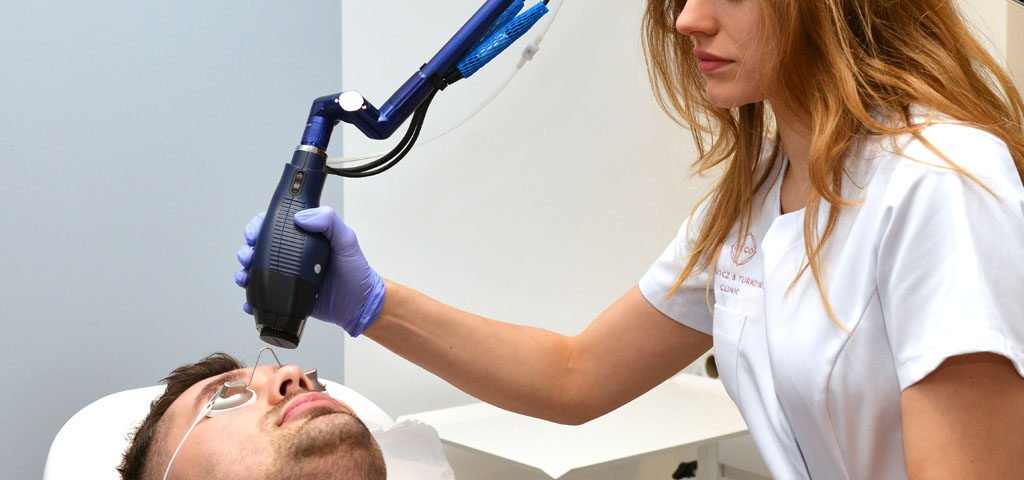 laserowe usuwanie przebarwien w warszawie laserowe usuwanie przebarwien w warszawie