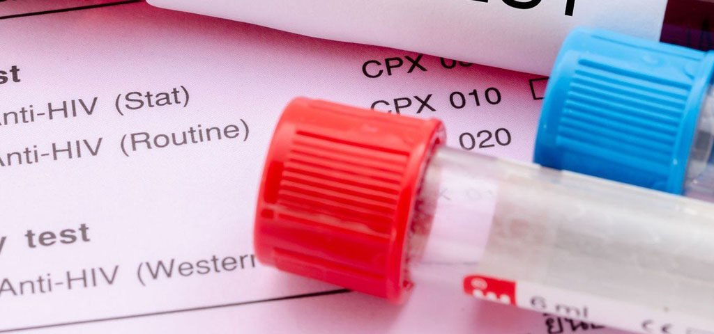 wirus hiv diagnostyka i leczenie