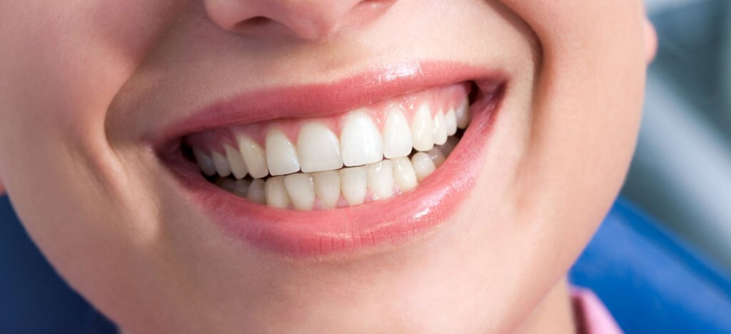 gummy smile jak leczyc usmiech dziaslowy