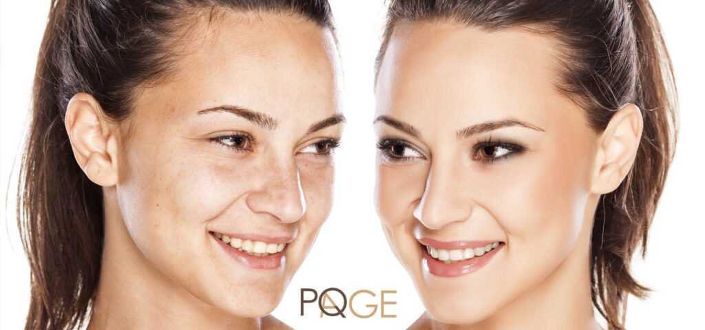 pq age