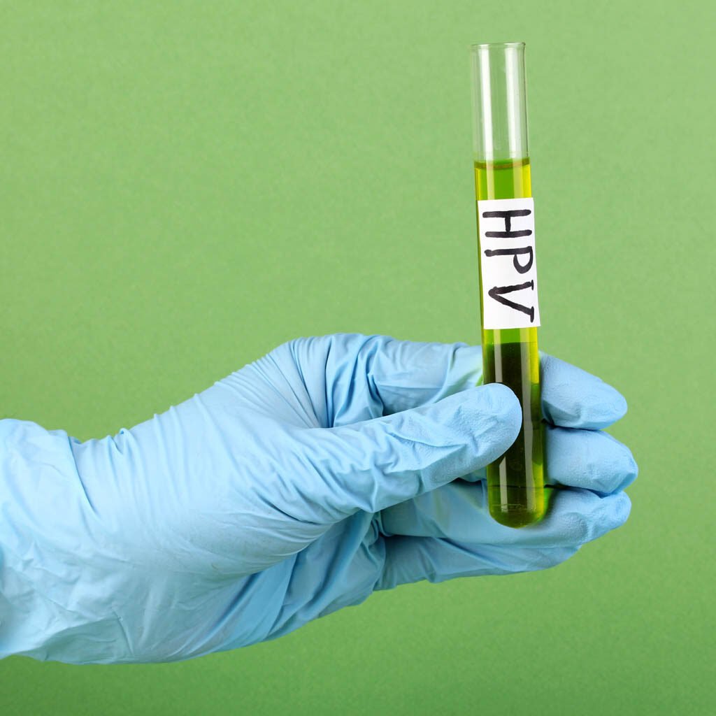 test hpv