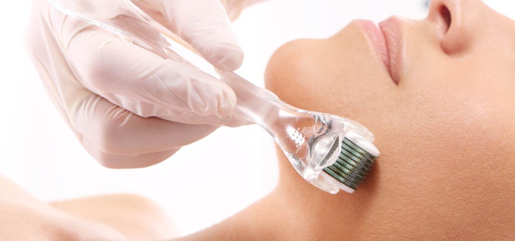 mezoterapia mikroiglowa roller