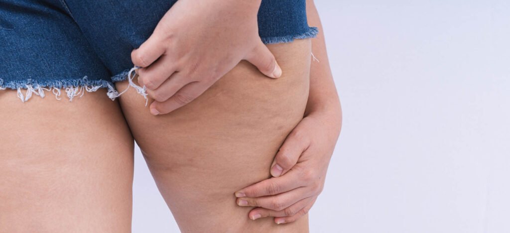 lipodystrofia