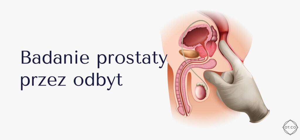 badanie prostaty badanie prostaty