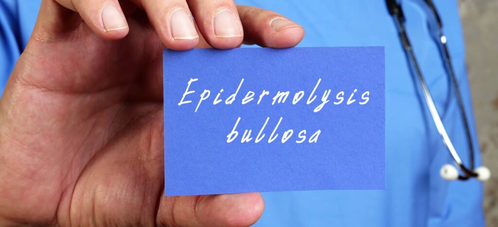 epidermolysis bullosa